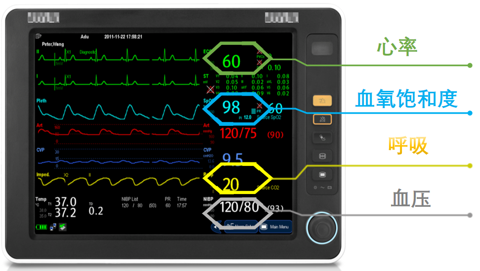 多参数监护仪怎么看十个要点带您充分了解“生命侦察兵” ——多参数监护仪_https://www.jmylbn.com_新闻资讯_第2张