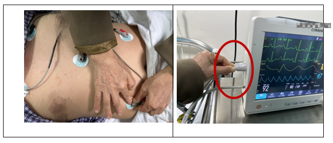 多参数监护仪怎么看十个要点带您充分了解“生命侦察兵” ——多参数监护仪_https://www.jmylbn.com_新闻资讯_第5张