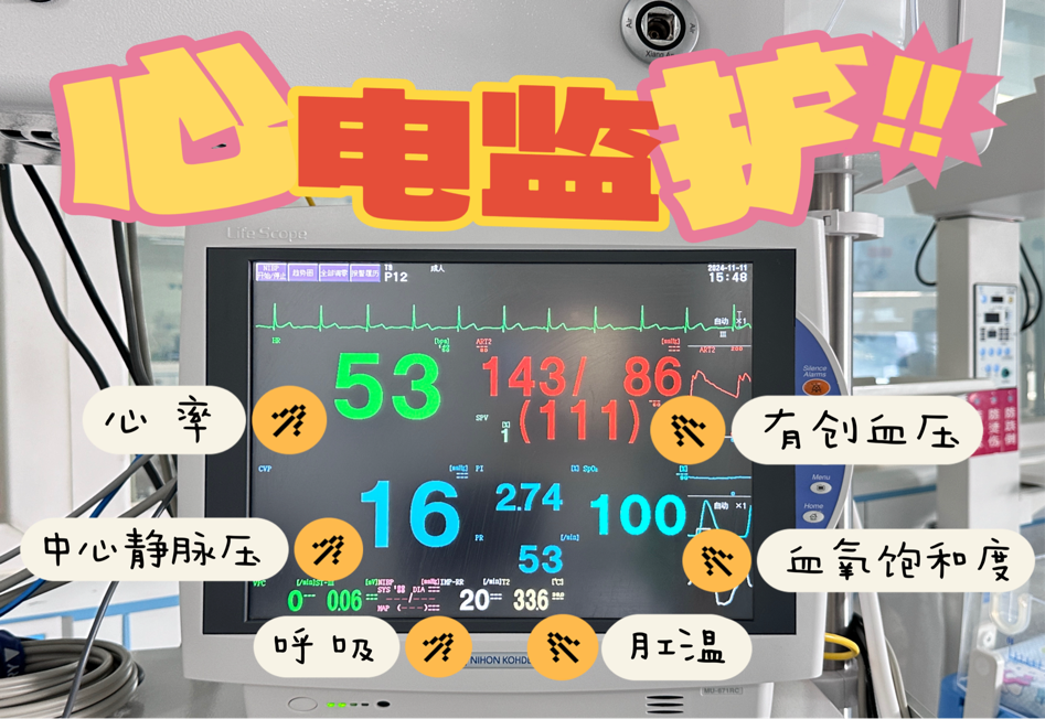 医疗监护设备有哪些【健康促进 科普先行】带你走进PICU ｜ 生命的守护者，PICU里无声的战士_https://www.jmylbn.com_新闻资讯_第8张