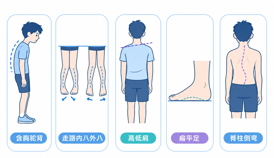体态问题科普插图.png