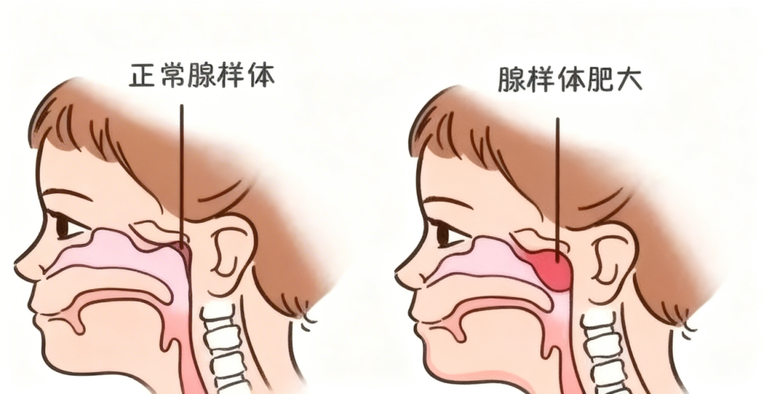 ce422ac5127dd689a0999a4067370252.png