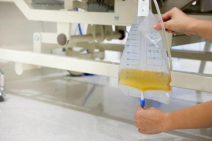 尿液引流袋怎么用带管回家之—导尿管的居家护理_https://www.jmylbn.com_新闻资讯_第5张