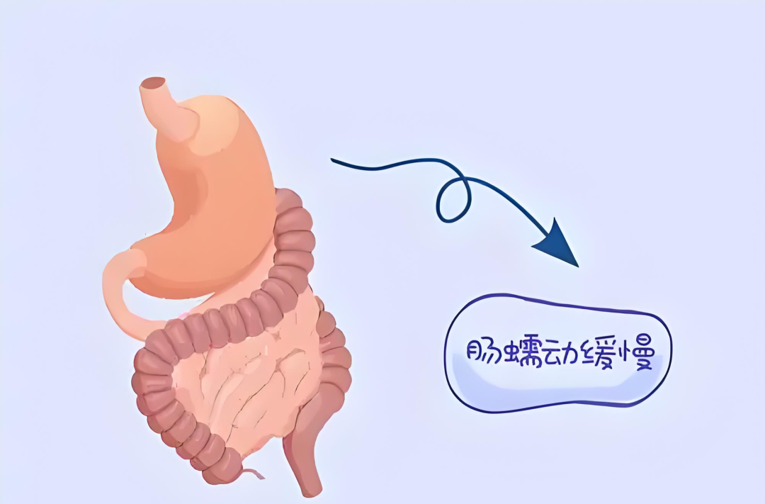 肠电图能查看什么【杏林科普】胃肠动力问题别着急，胃肠电图检查来帮您_https://www.jmylbn.com_新闻资讯_第5张
