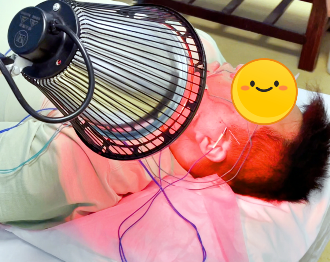 电针理疗是什么中医理疗与现代康复，助力面神经受损痊愈！_https://www.jmylbn.com_新闻资讯_第14张