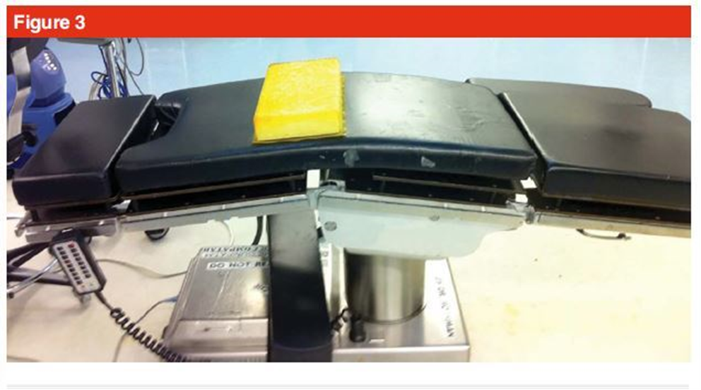 手术技巧：人工髋关节置换术，骨科医生须掌握！