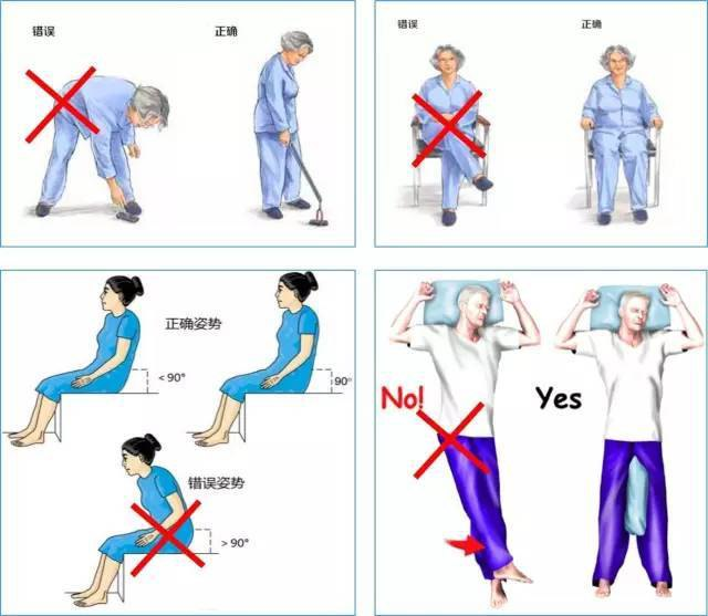 手术技巧：人工髋关节置换术，骨科医生须掌握！