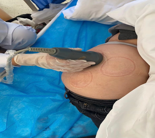 疼痛科怎么理疗丽江市人民医院疼痛科——理疗助力患者早日解除疼痛_https://www.jmylbn.com_新闻资讯_第8张