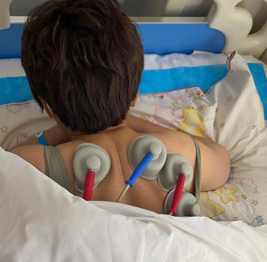 疼痛科怎么理疗丽江市人民医院疼痛科——理疗助力患者早日解除疼痛_https://www.jmylbn.com_新闻资讯_第10张