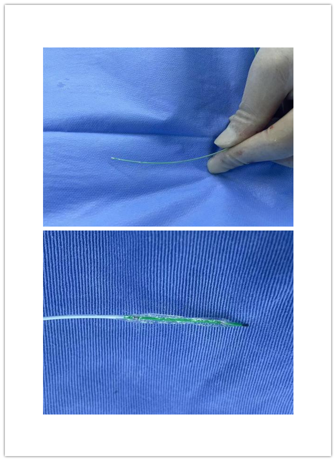 介入怎么进导管带您走进介入手术室，近距离了解冠脉介入手术_https://www.jmylbn.com_新闻资讯_第7张