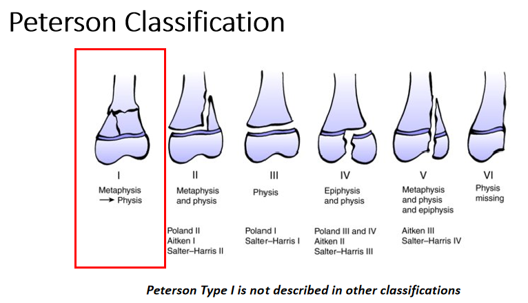 AO儿童骨折治疗原则，高清美图欣赏