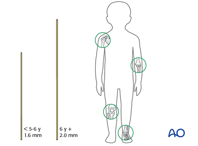 AO儿童骨折治疗原则，高清美图欣赏