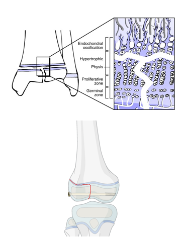 AO儿童骨折治疗原则，高清美图欣赏