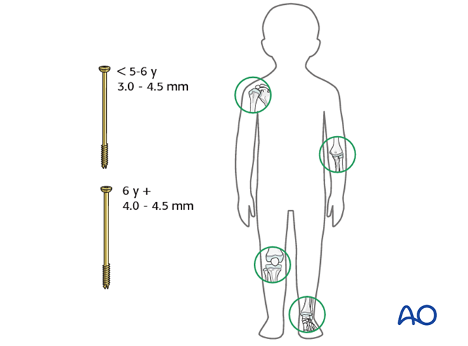 AO儿童骨折治疗原则，高清美图欣赏