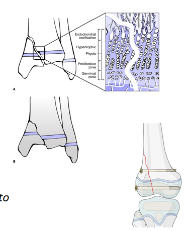 AO儿童骨折治疗原则，高清美图欣赏