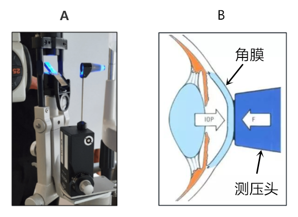 goldmann眼压计怎么读科普｜眼压测量的金标准是什么？_https://www.jmylbn.com_新闻资讯_第17张