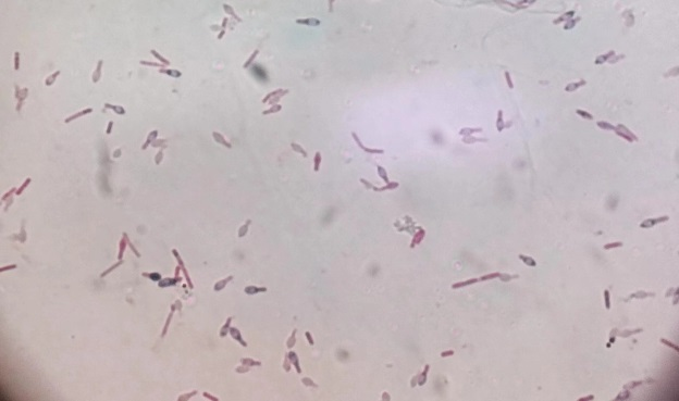 放进真空袋，就不怕食物过期了？这个隐患很多人都忽略了......(图3)