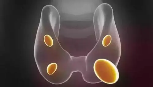 d-spect怎么检查【科普-健康知识】探寻角落里的“它”——SPECT／CT甲状旁腺显像_https://www.jmylbn.com_新闻资讯_第6张