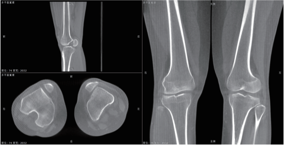 悬吊DR怎么安装悬吊动态三维DR  开启精准影像诊疗_https://www.jmylbn.com_新闻资讯_第4张