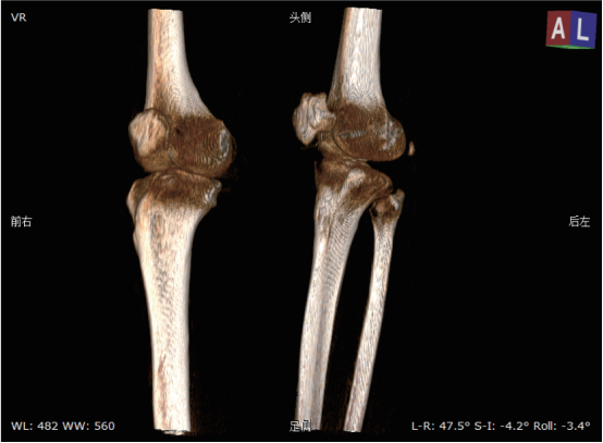 悬吊DR怎么安装悬吊动态三维DR  开启精准影像诊疗_https://www.jmylbn.com_新闻资讯_第6张