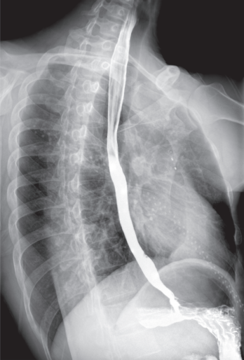 悬吊DR怎么安装悬吊动态三维DR  开启精准影像诊疗_https://www.jmylbn.com_新闻资讯_第3张