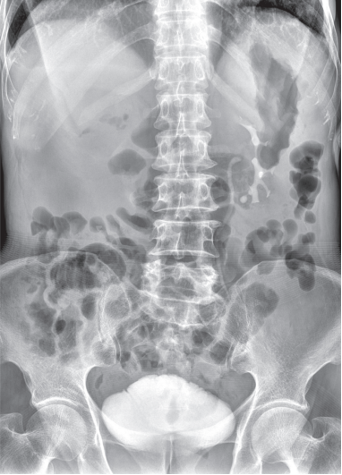 悬吊DR怎么安装悬吊动态三维DR  开启精准影像诊疗_https://www.jmylbn.com_新闻资讯_第5张