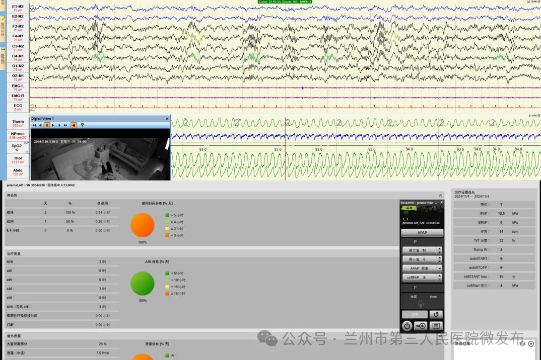 为什么呼吸机这么少【医院动态】总是打鼾睡不好，压力滴定少不了——睡眠医学科引进“家用呼吸机压力滴定系统”_https://www.jmylbn.com_新闻资讯_第4张