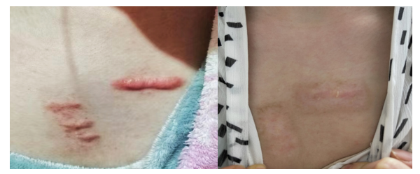 d-spect怎么检查华西天府医院“上新”！核医学科的SPECT／CT、PET／CT检查现在可以做咯~_https://www.jmylbn.com_新闻资讯_第12张