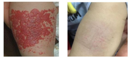 d-spect怎么检查华西天府医院“上新”！核医学科的SPECT／CT、PET／CT检查现在可以做咯~_https://www.jmylbn.com_新闻资讯_第11张