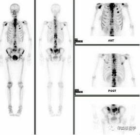 d-spect怎么检查华西天府医院“上新”！核医学科的SPECT／CT、PET／CT检查现在可以做咯~_https://www.jmylbn.com_新闻资讯_第6张