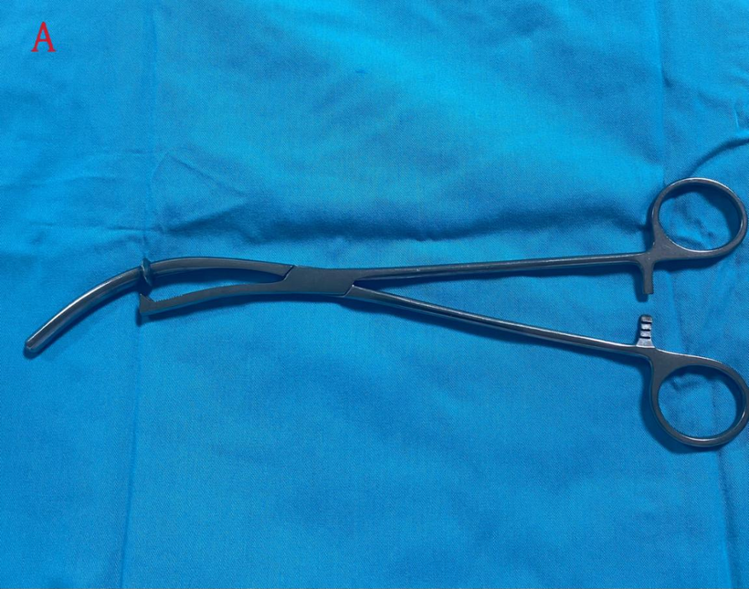 举宫是什么一文解析！腹腔镜全子宫切除术中的举宫要领_https://www.jmylbn.com_新闻资讯_第2张