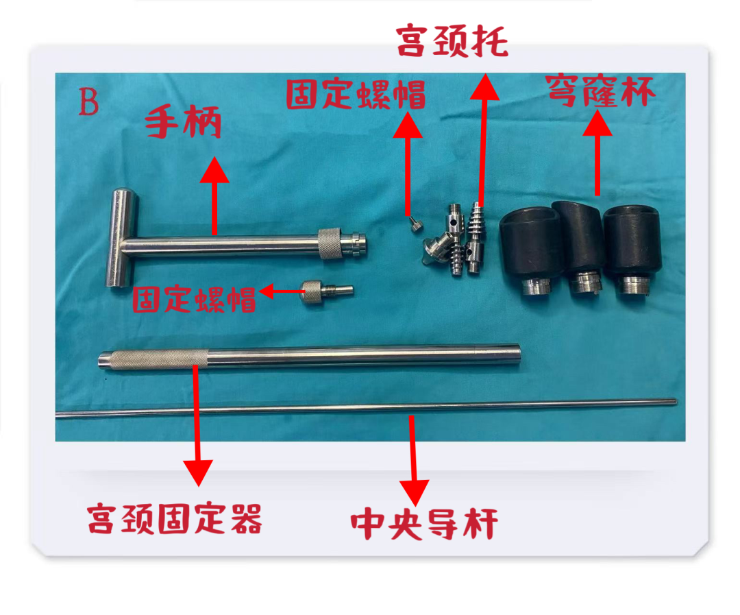 举宫是什么一文解析！腹腔镜全子宫切除术中的举宫要领_https://www.jmylbn.com_新闻资讯_第3张