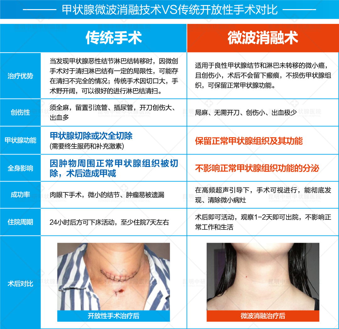 微波治疗机怎么使用多模态超微创微波消融技术治疗甲状腺疾病，实现微创、无痕、保腺体！_https://www.jmylbn.com_新闻资讯_第5张