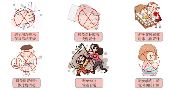 什么是安全留置针＂静＂享安全、＂针＂的实用，一起认识静脉留置针_https://www.jmylbn.com_新闻资讯_第5张