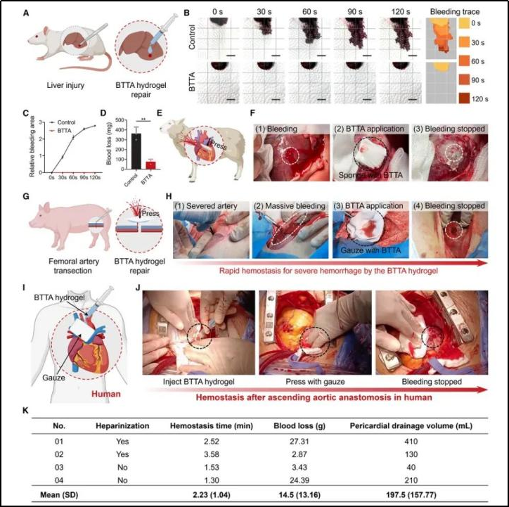 湖南止血材料怎么挂网【会员动态】锡创投：锡创智研 ｜ 大外科耗材的结构性变革：微创浪潮下的智能升级与国产替代_https://www.jmylbn.com_新闻资讯_第10张