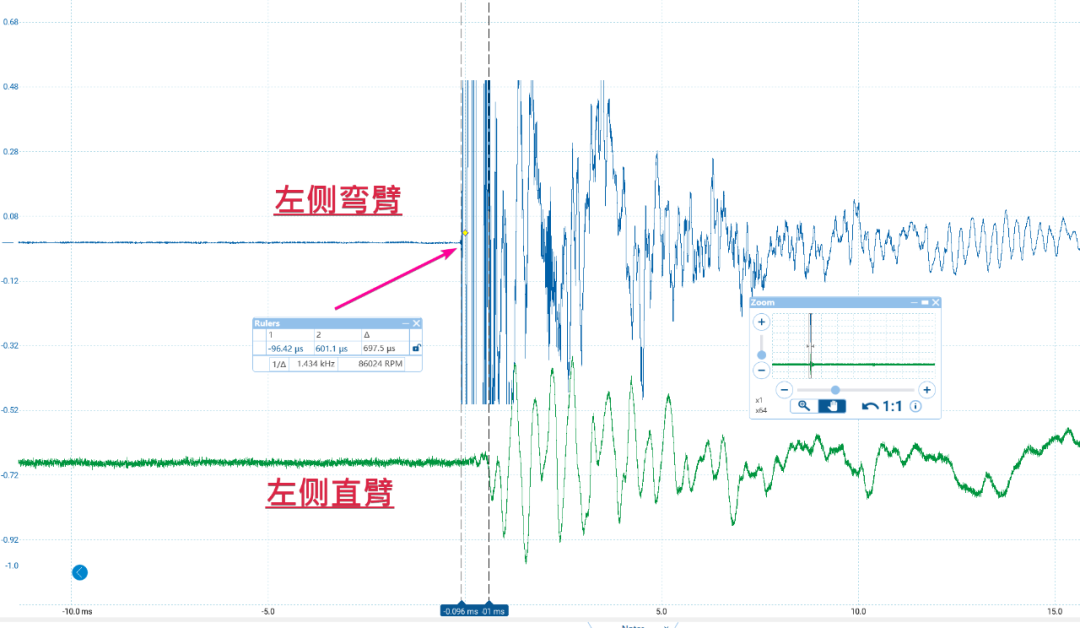 左侧下弯臂 vs 左侧直臂信号对比：下弯臂方位更强