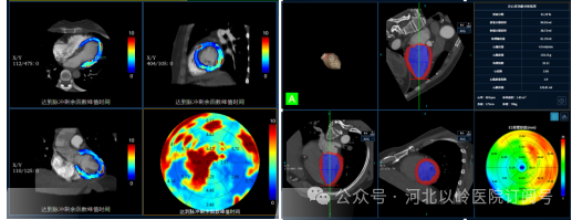 太行ct怎么样【硬核设备】河北以岭医院引进超高端 CT，开启精准医疗新篇章_https://www.jmylbn.com_新闻资讯_第10张