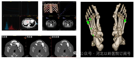 太行ct怎么样【硬核设备】河北以岭医院引进超高端 CT，开启精准医疗新篇章_https://www.jmylbn.com_新闻资讯_第14张