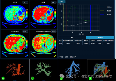 太行ct怎么样【硬核设备】河北以岭医院引进超高端 CT，开启精准医疗新篇章_https://www.jmylbn.com_新闻资讯_第13张