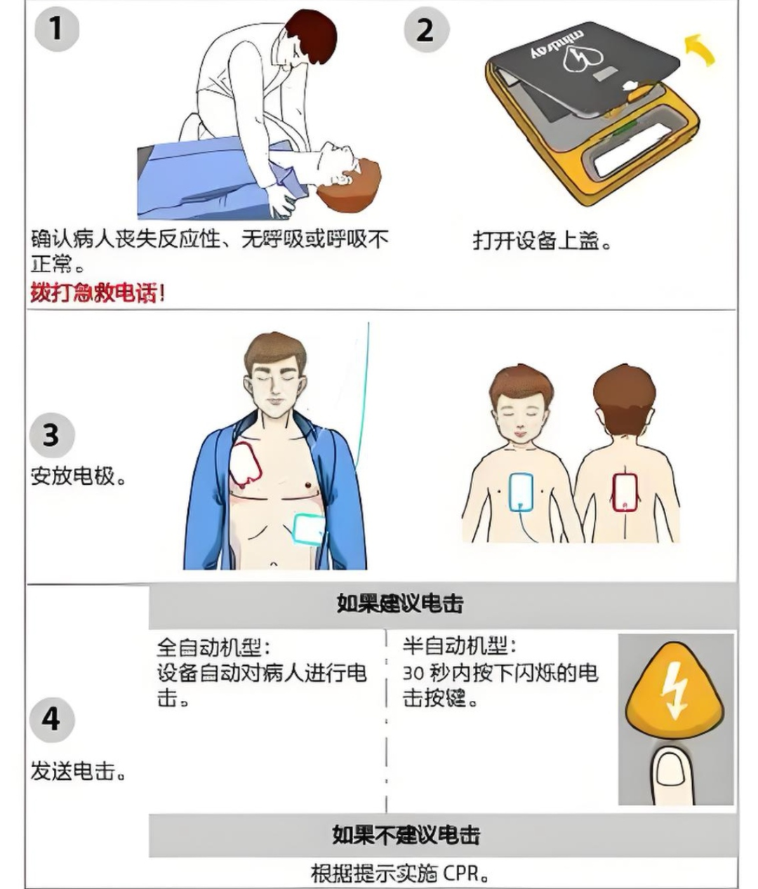 aed除颤仪怎么用【健康科普】自动体外除颤仪AED如何使用_https://www.jmylbn.com_新闻资讯_第2张