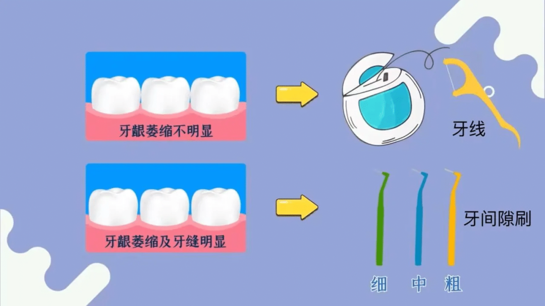 牙线的邪修用法