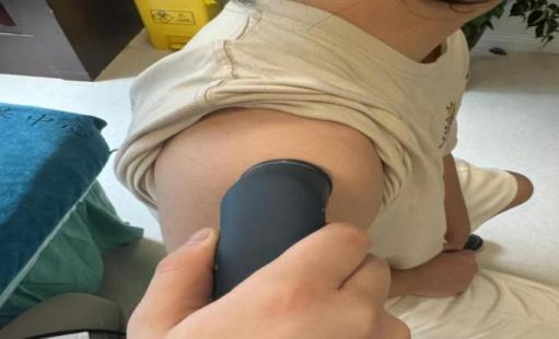 小声波 大能量丨重医附属璧山医院脊养中心超声波治疗守护你的运动