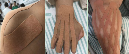 重医附属璧山医院脊养中心：中西结合，技术引领康养新风尚