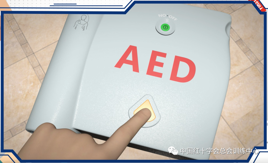 aed电极贴怎么贴使用AED时，电极片贴哪里才对？这堂“暑假安全课”细节满满！_https://www.jmylbn.com_新闻资讯_第6张