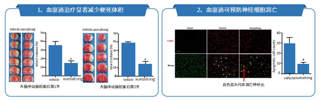 怎么用医疗灌注改善灌注+保护神经｜注射用血塞通（冻干）多维护航卒中治疗_https://www.jmylbn.com_新闻资讯_第7张