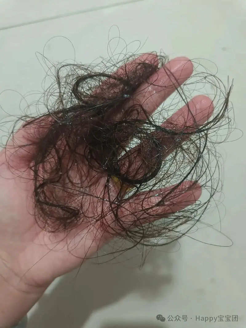 孕期脱发是什么原因？吃芝麻糊能改善吗？