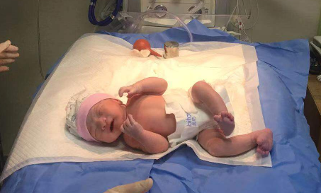 为什么剪脐带要先夹住为什么婴儿一出生就哭，是害怕还是剪脐带疼？看完你就明白了_https://www.jmylbn.com_新闻资讯_第3张