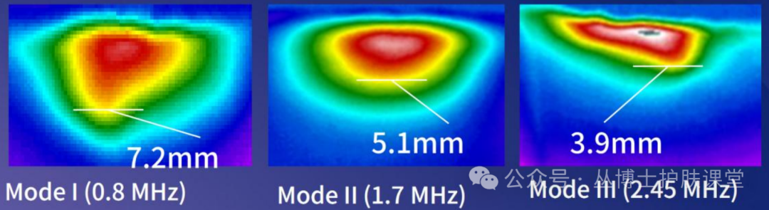 多极射频是什么《医用射频皮肤美容与治疗专家共识》解读（1）射频的分类与作用原理_https://www.jmylbn.com_新闻资讯_第9张