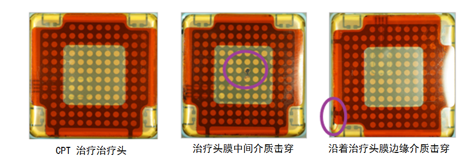 耦合剂怎么加热热玛吉100问（1）_https://www.jmylbn.com_新闻资讯_第13张