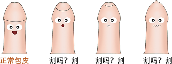 包皮环切器是什么东西儿童包皮手术该怎么做——一次性包皮环切器_https://www.jmylbn.com_新闻资讯_第2张