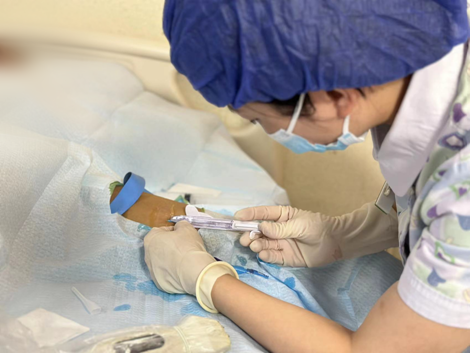 导什么针什么作用静脉输液新选择｜ “迷你”中线导管，“一针”管全程！_https://www.jmylbn.com_新闻资讯_第2张